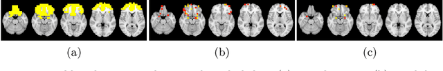 Figure 4 for Prediction of Autism Treatment Response from Baseline fMRI using Random Forests and Tree Bagging