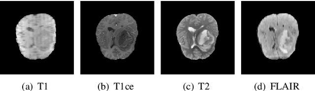 Figure 1 for Data Augmentation For Medical MR Image Using Generative Adversarial Networks