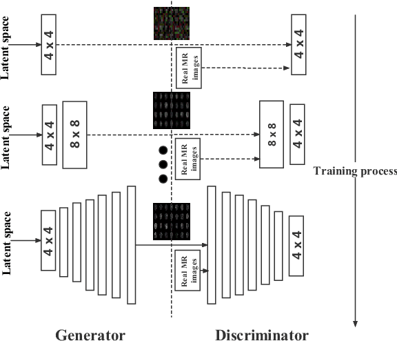 Figure 4 for Data Augmentation For Medical MR Image Using Generative Adversarial Networks