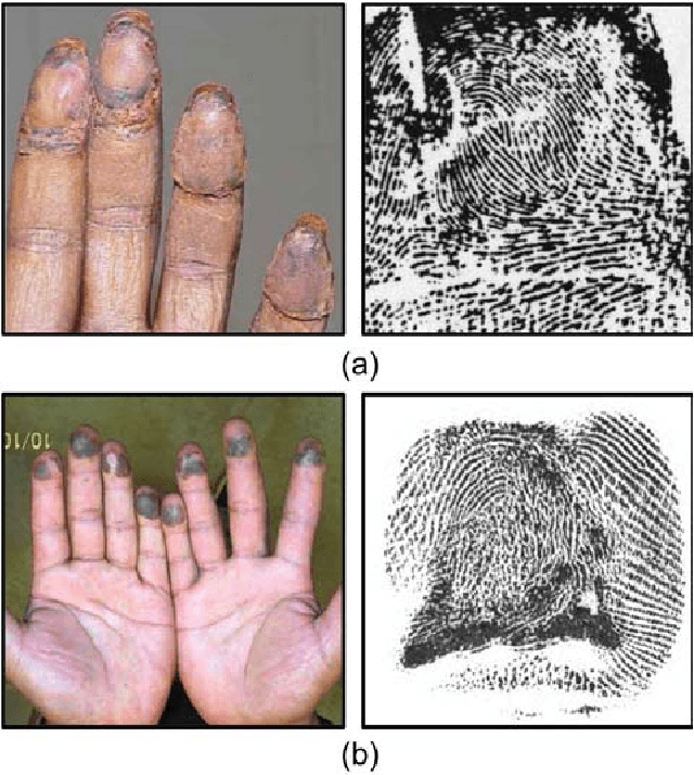 Figure 1 for Altered Fingerprints: Detection and Localization