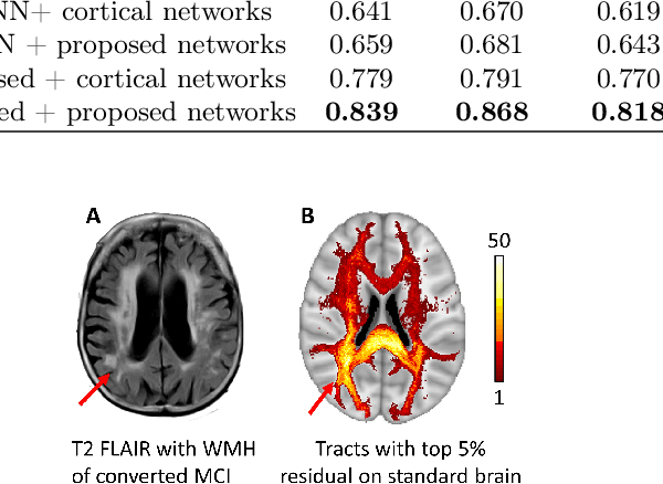 Figure 4 for Predicting conversion of mild cognitive impairment to Alzheimer's disease