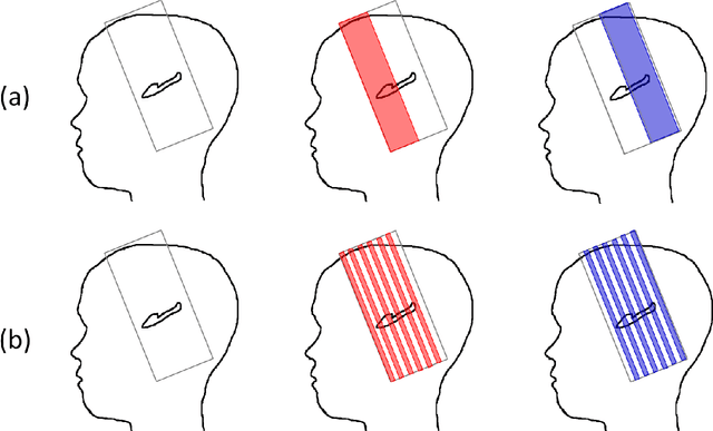 Figure 3 for Robust imaging of hippocampal inner structure at 7T: in vivo acquisition protocol and methodological choices