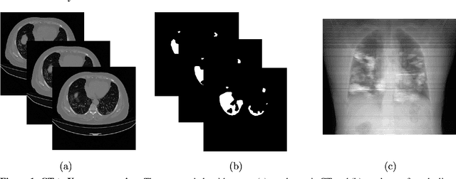 Figure 1 for COVID-19 Lung Lesion Segmentation Using a Sparsely Supervised Mask R-CNN on Chest X-rays Automatically Computed from Volumetric CTs