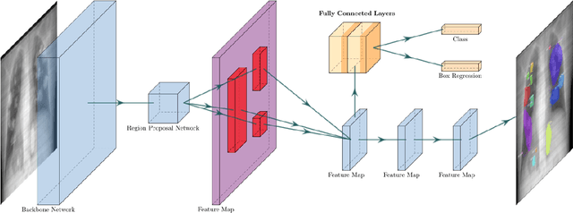 Figure 3 for COVID-19 Lung Lesion Segmentation Using a Sparsely Supervised Mask R-CNN on Chest X-rays Automatically Computed from Volumetric CTs