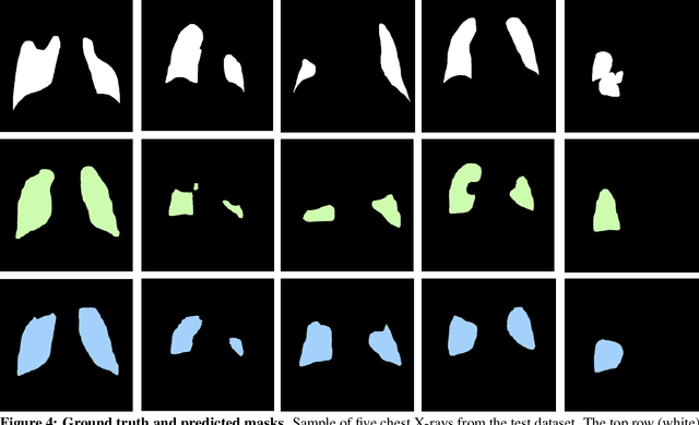 Figure 4 for COVID-19 Lung Lesion Segmentation Using a Sparsely Supervised Mask R-CNN on Chest X-rays Automatically Computed from Volumetric CTs