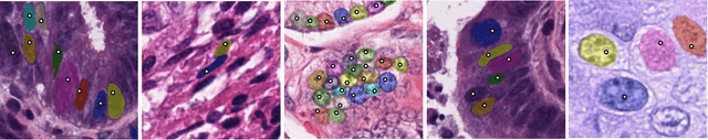 Figure 1 for NuClick: From Clicks in the Nuclei to Nuclear Boundaries