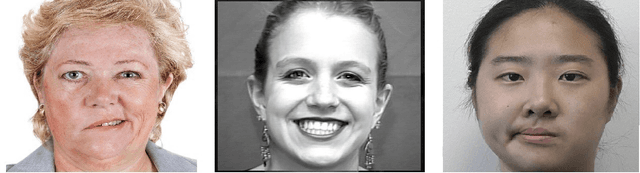Figure 1 for 3DPalsyNet: A Facial Palsy Grading and Motion Recognition Framework using Fully 3D Convolutional Neural Networks