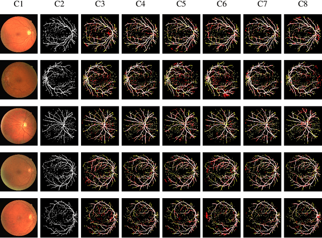 Figure 2 for Neural Network Compression by Joint Sparsity Promotion and Redundancy Reduction