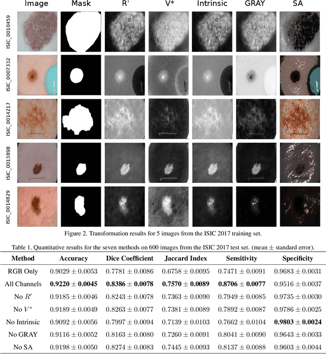 Figure 2 for Illumination-based Transformations Improve Skin Lesion Segmentation in Dermoscopic Images