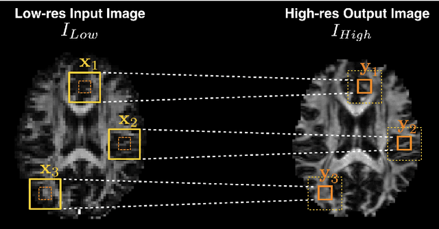 Figure 3 for Uncertainty Quantification in Deep Learning for Safer Neuroimage Enhancement