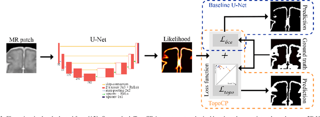 Figure 1 for Segmentation of the cortical plate in fetal brain MRI with a topological loss