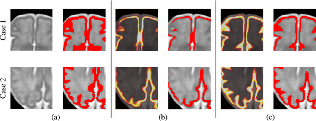 Figure 3 for Segmentation of the cortical plate in fetal brain MRI with a topological loss