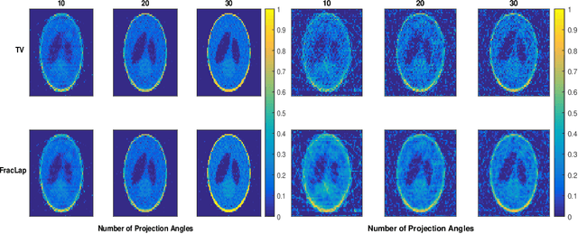 Figure 2 for Bilevel Optimization, Deep Learning and Fractional Laplacian Regularization with Applications in Tomography