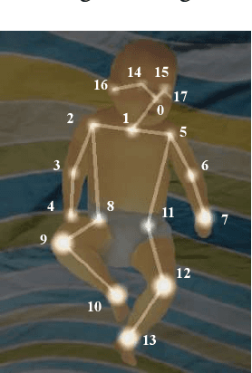 Figure 2 for Cerebral Palsy Prediction with Frequency Attention Informed Graph Convolutional Networks