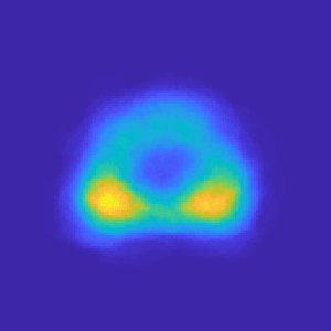 Figure 2 for Prostate cancer inference via weakly-supervised learning using a large collection of negative MRI