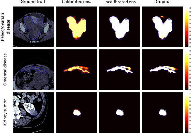Figure 4 for Calibrating Ensembles for Scalable Uncertainty Quantification in Deep Learning-based Medical Segmentation