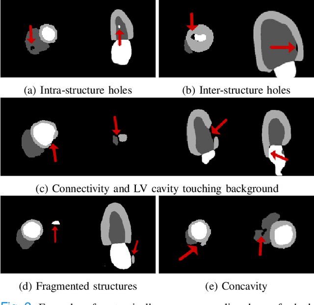 Figure 2 for Cardiac Segmentation with Strong Anatomical Guarantees