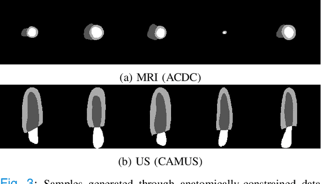 Figure 3 for Cardiac Segmentation with Strong Anatomical Guarantees