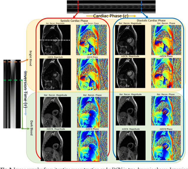 Figure 3 for Deep learning within a priori temporal feature spaces for large-scale dynamic MR image reconstruction: Application to 5-D cardiac MR Multitasking