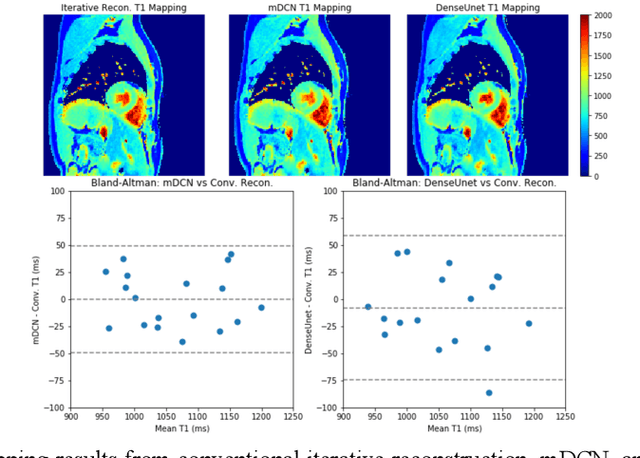 Figure 4 for Deep learning within a priori temporal feature spaces for large-scale dynamic MR image reconstruction: Application to 5-D cardiac MR Multitasking