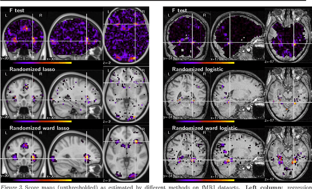 Figure 3 for Small-sample Brain Mapping: Sparse Recovery on Spatially Correlated Designs with Randomization and Clustering