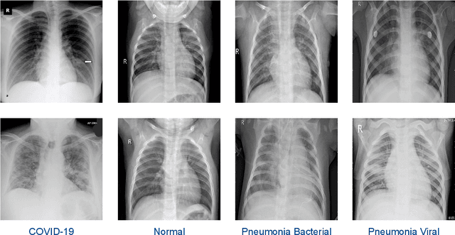 Figure 1 for Deep COVID-19 Recognition using Chest X-ray Images: A Comparative Analysis