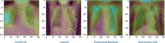 Figure 3 for Deep COVID-19 Recognition using Chest X-ray Images: A Comparative Analysis