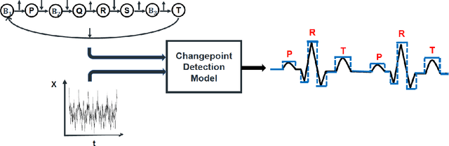 Figure 1 for A Graph-constrained Changepoint Detection Approach for ECG Segmentation