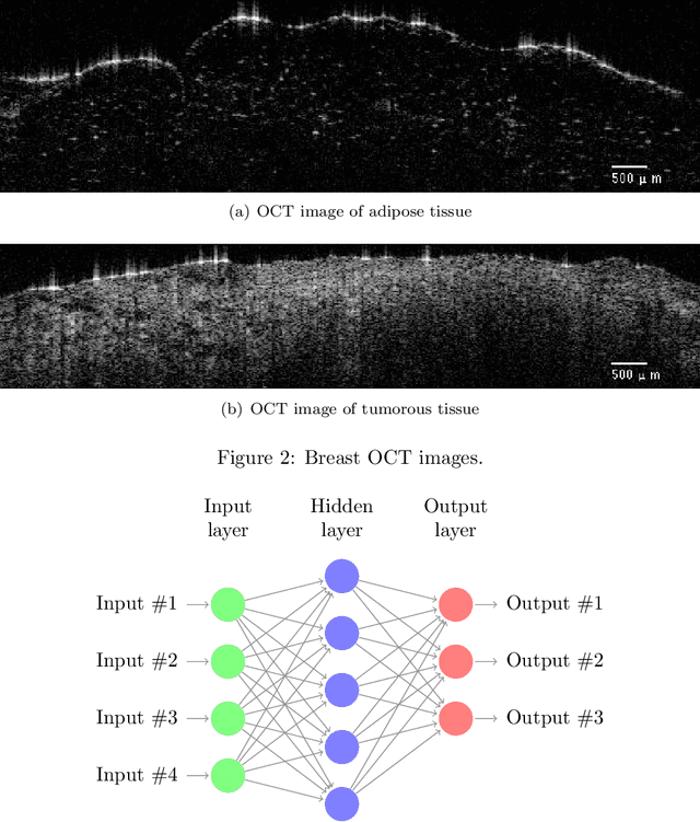 Figure 3 for Intraoperative margin assessment of human breast tissue in optical coherence tomography images using deep neural networks
