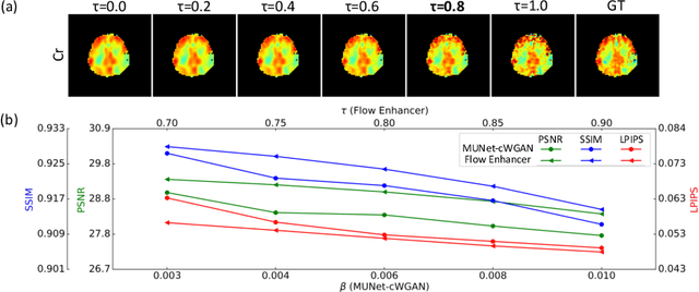 Figure 4 for Flow-based Visual Quality Enhancer for Super-resolution Magnetic Resonance Spectroscopic Imaging