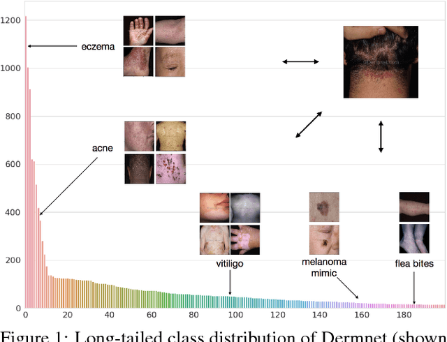 Figure 1 for Prototypical Clustering Networks for Dermatological Disease Diagnosis