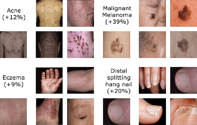 Figure 3 for Prototypical Clustering Networks for Dermatological Disease Diagnosis
