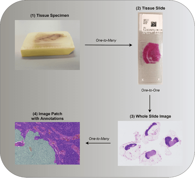 Figure 2 for Deep Learning for Whole Slide Image Analysis: An Overview