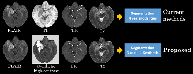 Figure 1 for Brain Tumor Synthetic Segmentation in 3D Multimodal MRI Scans