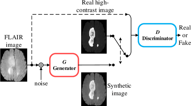 Figure 3 for Brain Tumor Synthetic Segmentation in 3D Multimodal MRI Scans
