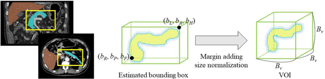 Figure 3 for Regression Forest-Based Atlas Localization and Direction Specific Atlas Generation for Pancreas Segmentation