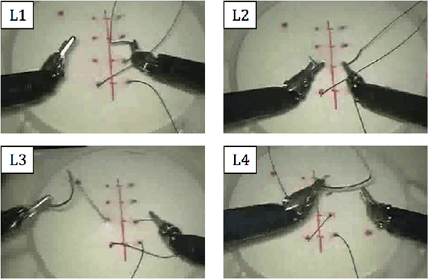 Figure 1 for Weakly Supervised Recognition of Surgical Gestures