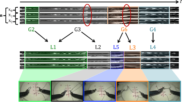 Figure 2 for Weakly Supervised Recognition of Surgical Gestures