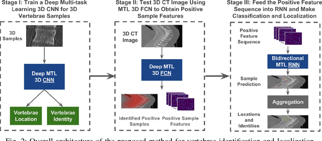 Figure 2 for Joint Vertebrae Identification and Localization in Spinal CT Images by Combining Short- and Long-Range Contextual Information