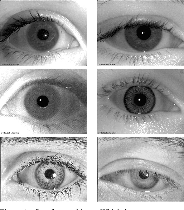 Figure 1 for CNN Hyperparameter tuning applied to Iris Liveness Detection