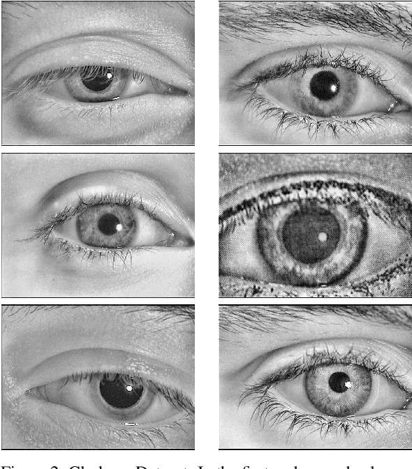 Figure 2 for CNN Hyperparameter tuning applied to Iris Liveness Detection