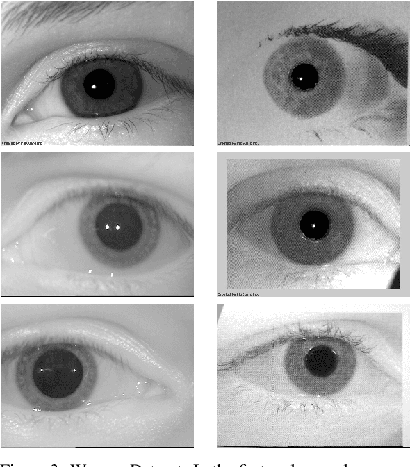 Figure 4 for CNN Hyperparameter tuning applied to Iris Liveness Detection