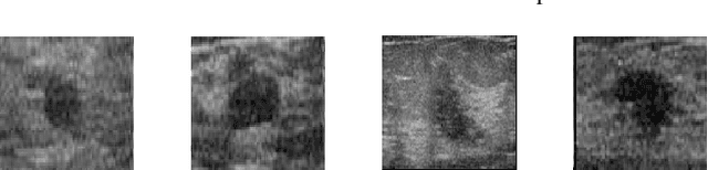 Figure 3 for Ultrasound Image Classification using ACGAN with Small Training Dataset