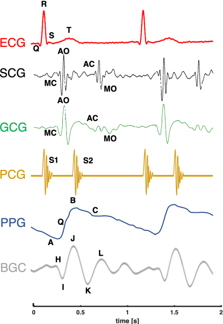 Figure 1 for BIOWISH: Biometric Recognition using Wearable Inertial Sensors detecting Heart Activity