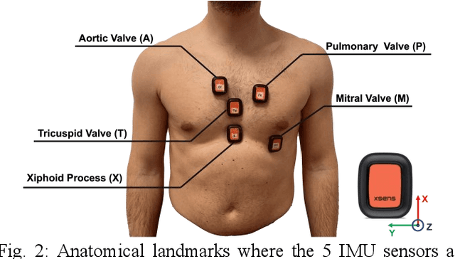 Figure 2 for BIOWISH: Biometric Recognition using Wearable Inertial Sensors detecting Heart Activity