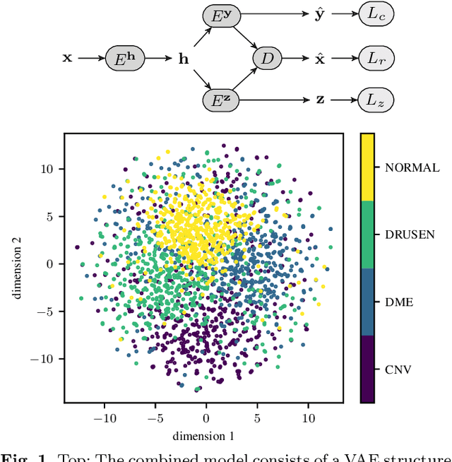 Figure 1 for Retinal OCT disease classification with variational autoencoder regularization