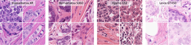 Figure 1 for Quantifying the Scanner-Induced Domain Gap in Mitosis Detection