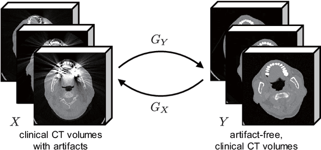 Figure 1 for Three-dimensional Generative Adversarial Nets for Unsupervised Metal Artifact Reduction