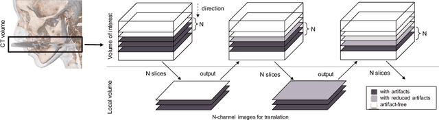 Figure 3 for Three-dimensional Generative Adversarial Nets for Unsupervised Metal Artifact Reduction