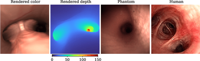 Figure 4 for Adversarial Domain Feature Adaptation for Bronchoscopic Depth Estimation